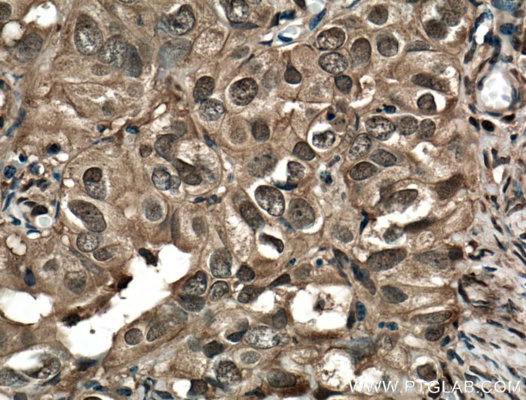 STAT1 Monoclonal antibody