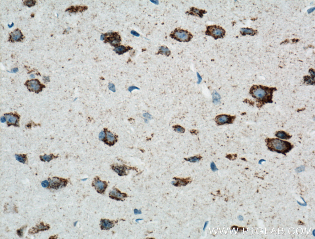 ARC Monoclonal antibody