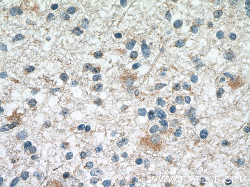 SMAD1 Monoclonal antibody