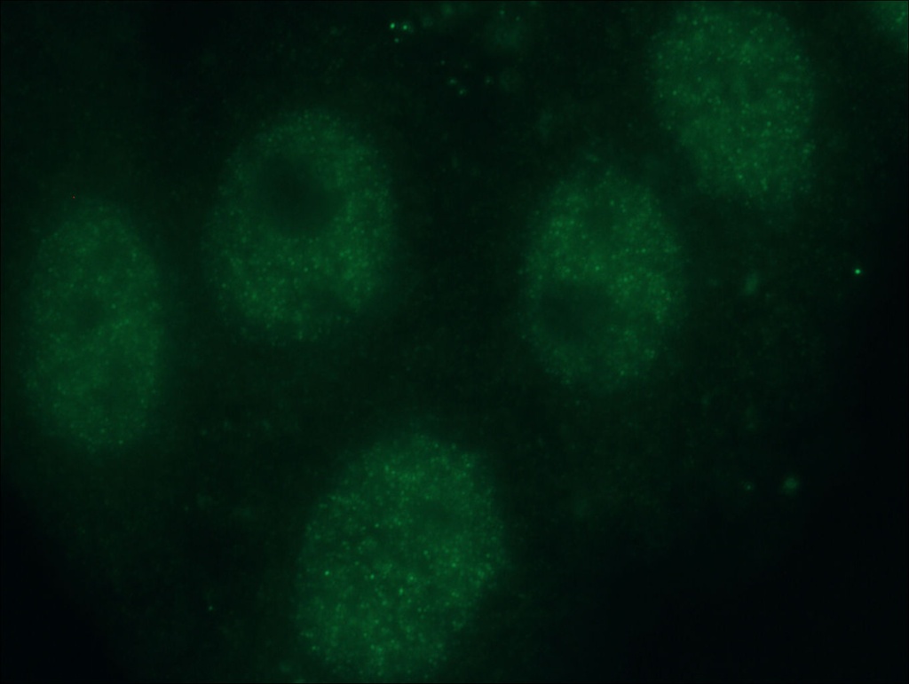 SMARCA4/BRG1 Monoclonal antibody