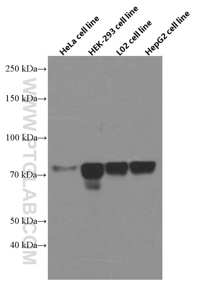 FOXC1 Monoclonal antibody