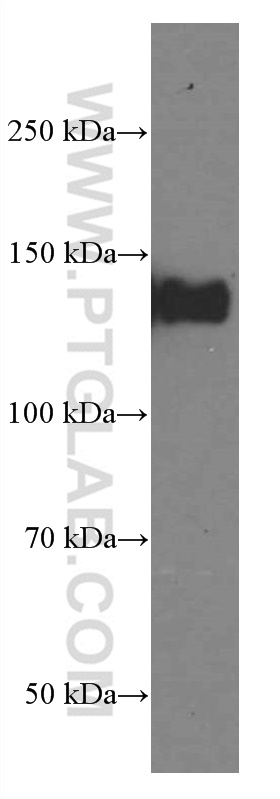 LATS1 Monoclonal antibody
