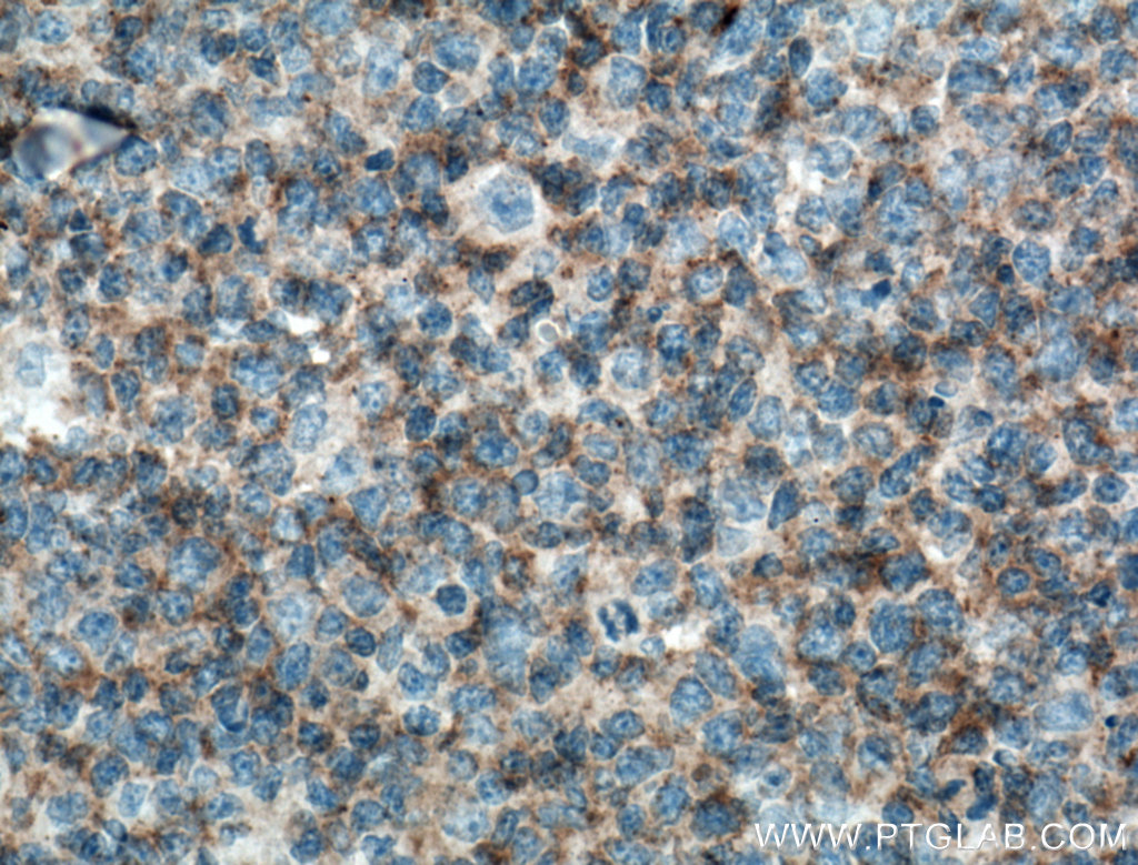 c-Cbl Monoclonal antibody