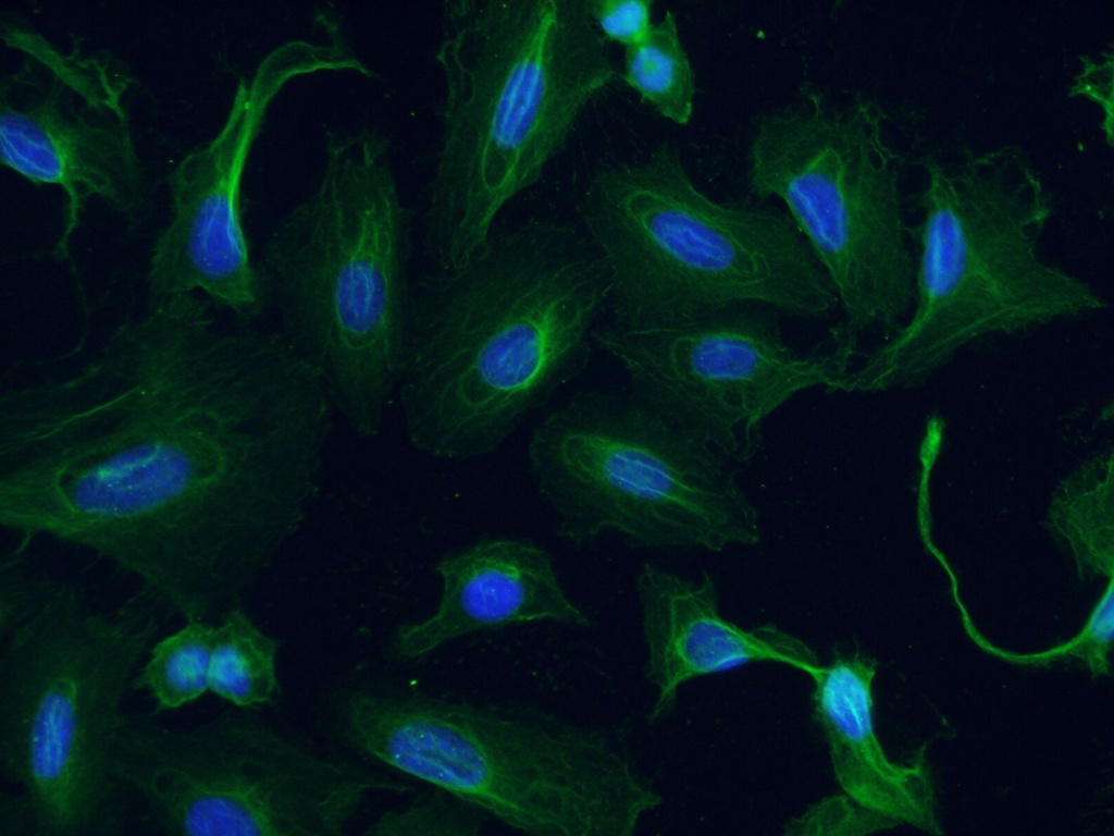 GTDC1 Monoclonal antibody
