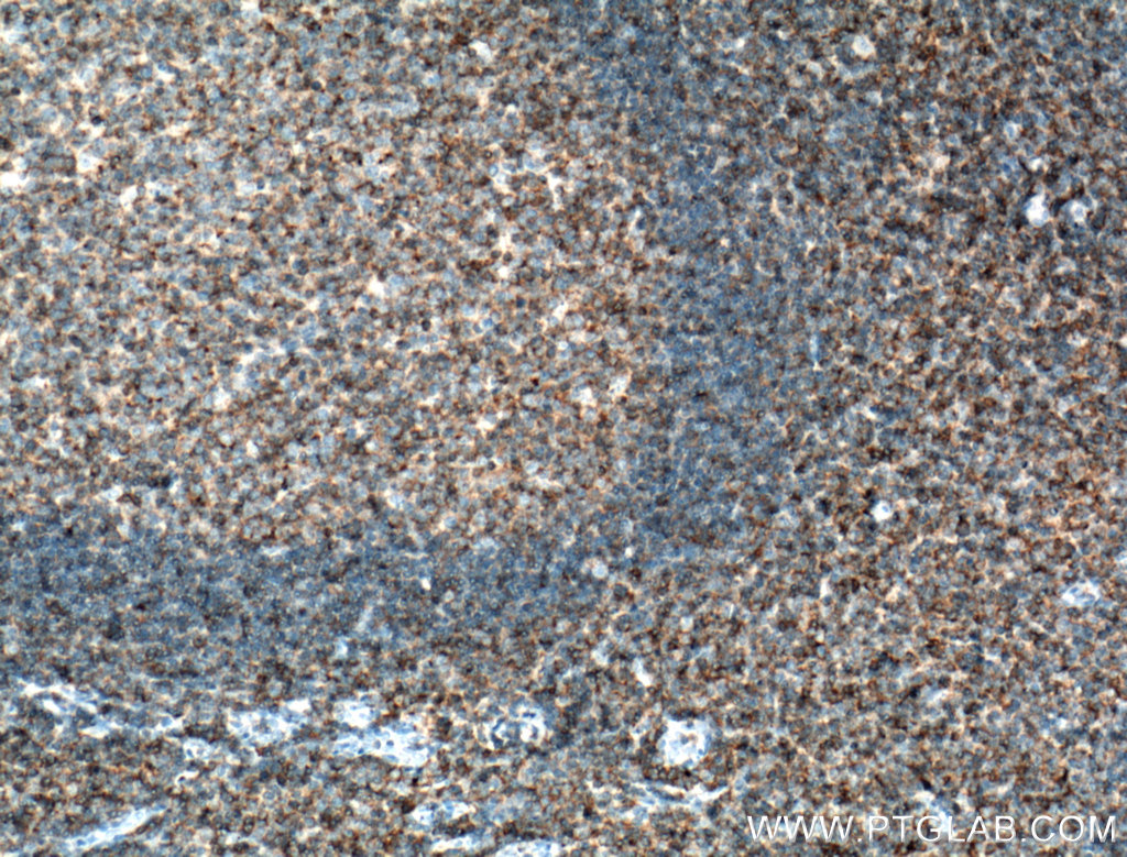 CD100 Monoclonal antibody