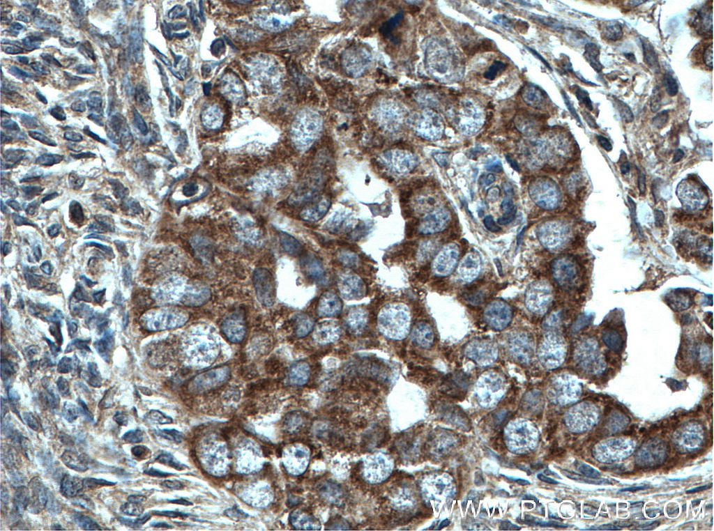 CHCHD5 Monoclonal antibody
