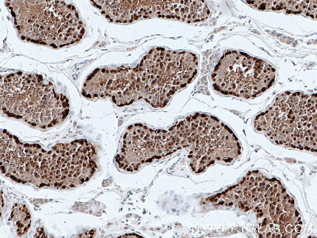 DNAJB6 Monoclonal antibody