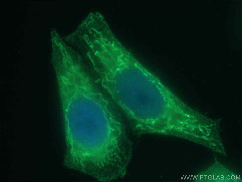 SDHA Monoclonal antibody