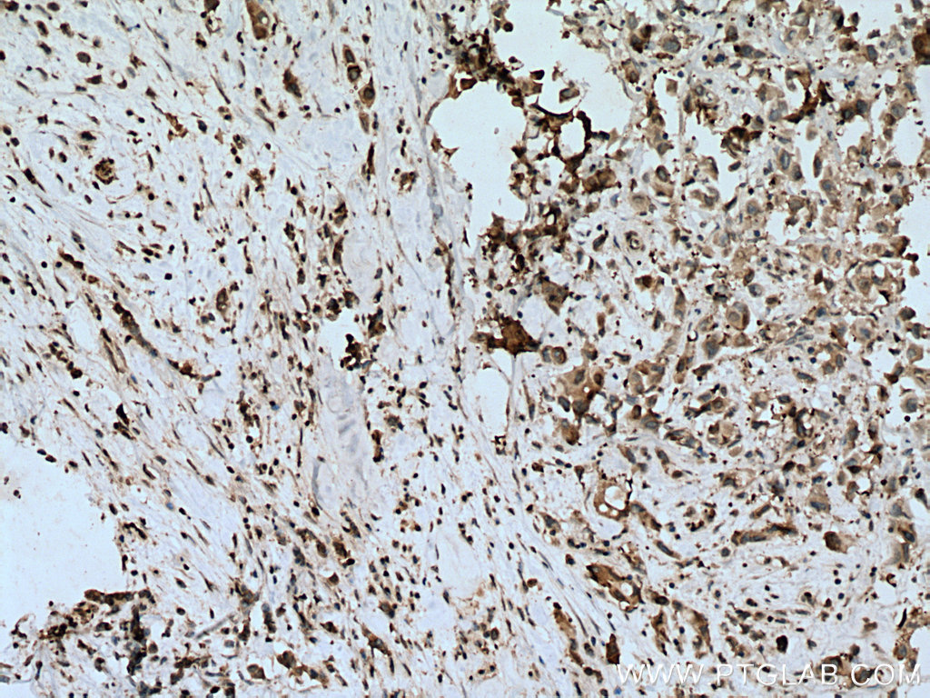 FASN Monoclonal antibody
