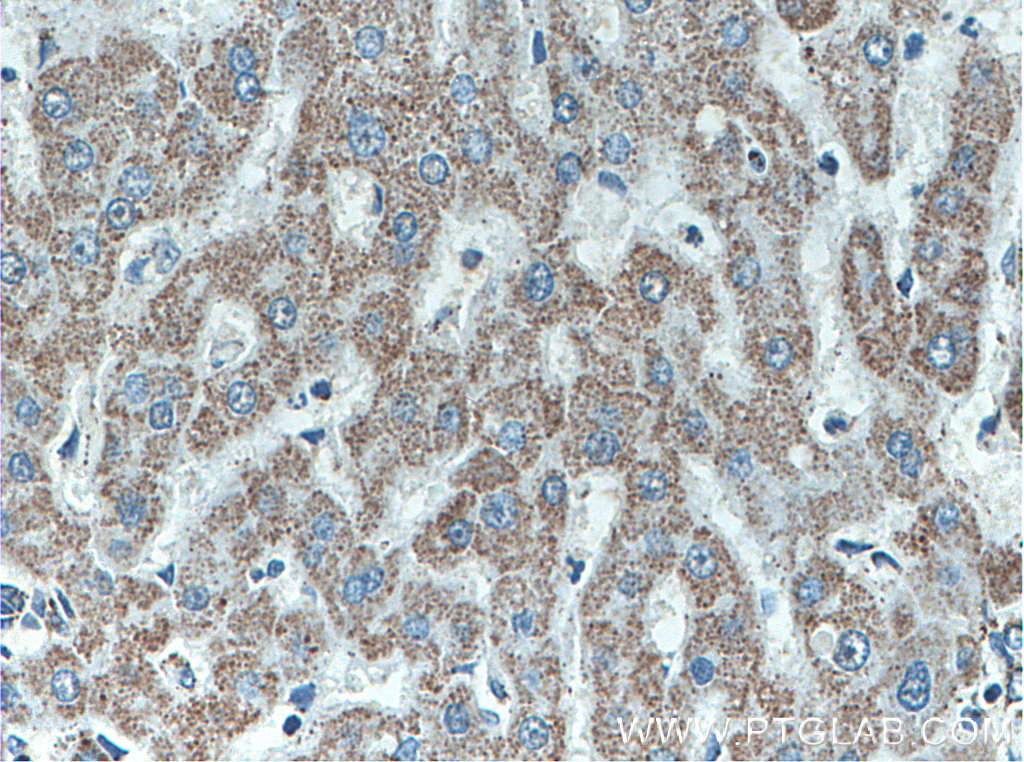 ATPB Monoclonal antibody
