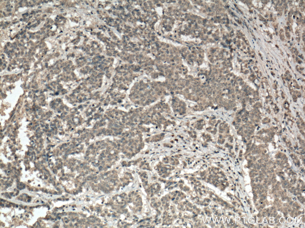 PALLD,palladin Monoclonal antibody