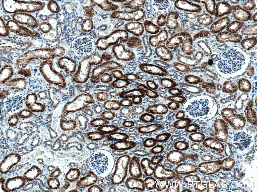 AGXT2 Monoclonal antibody