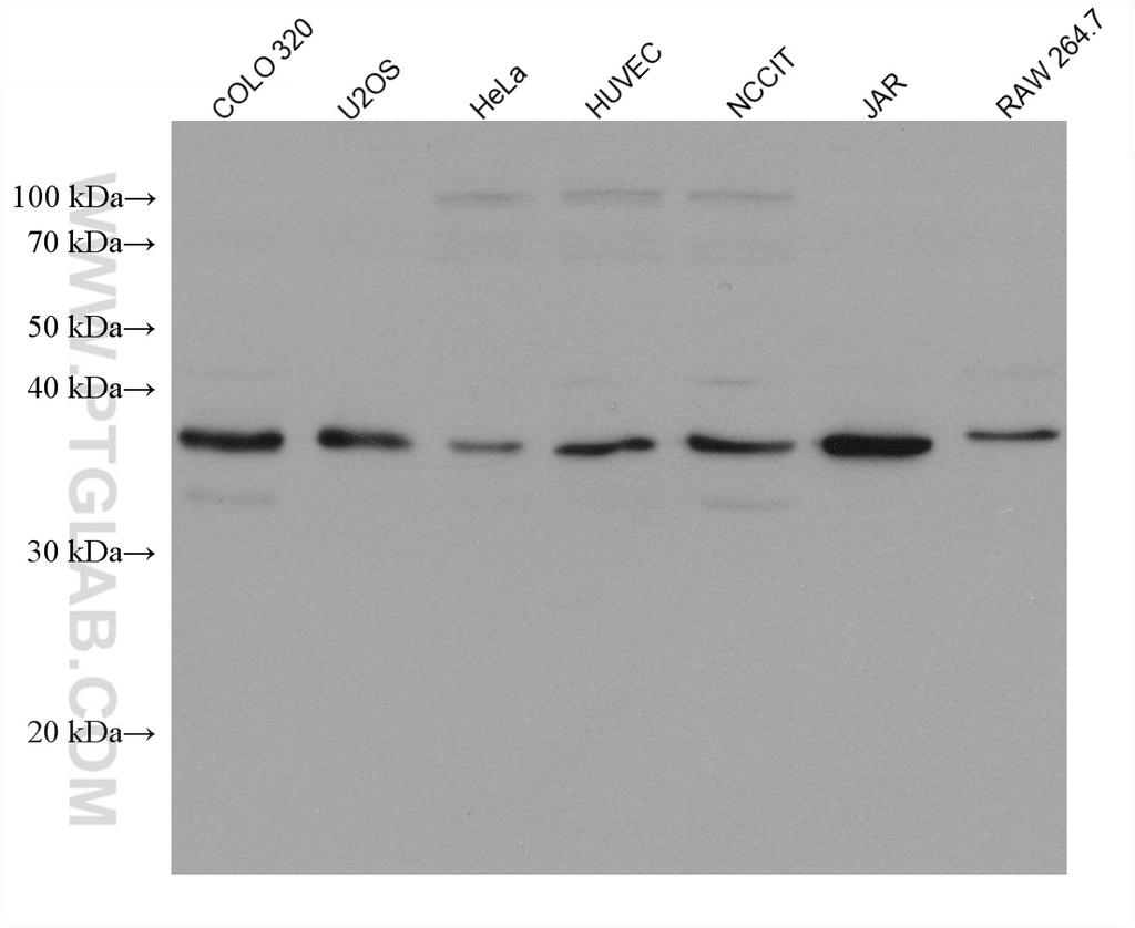 RANKL Monoclonal antibody