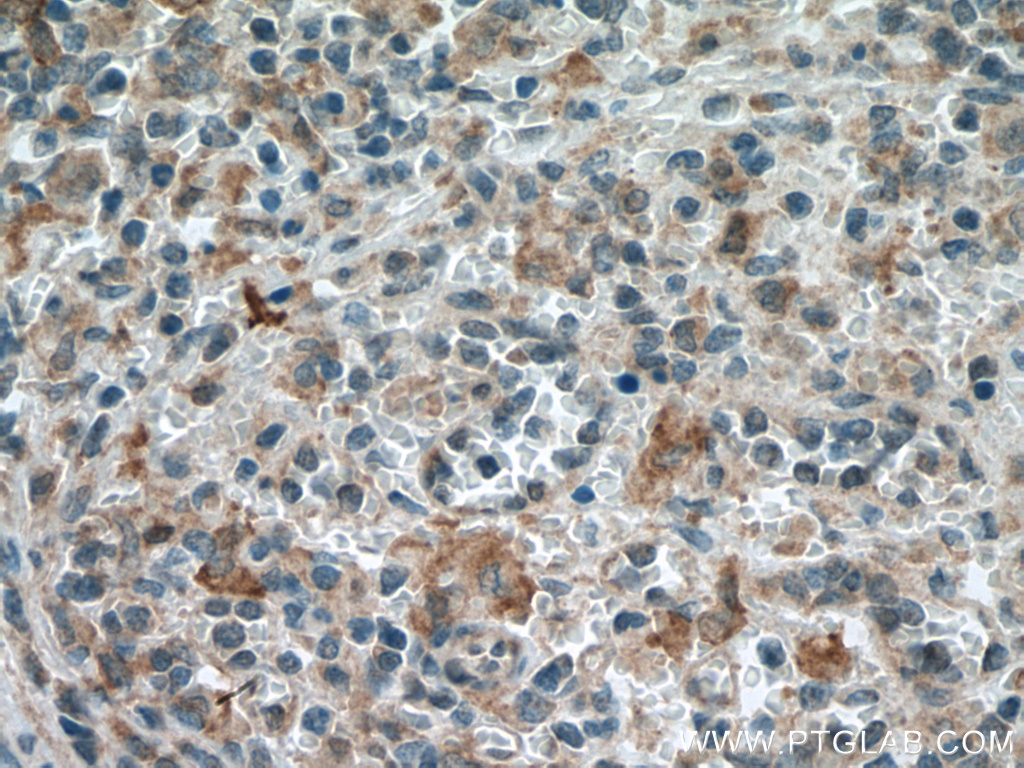 MTHFR Monoclonal antibody