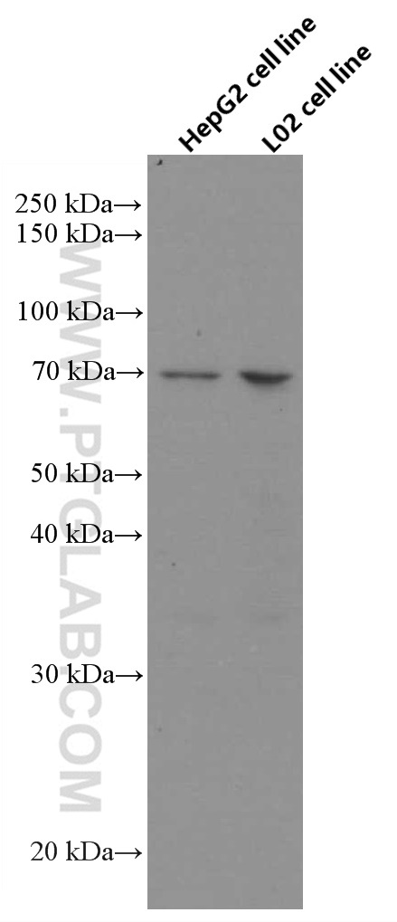 ND5 Monoclonal antibody