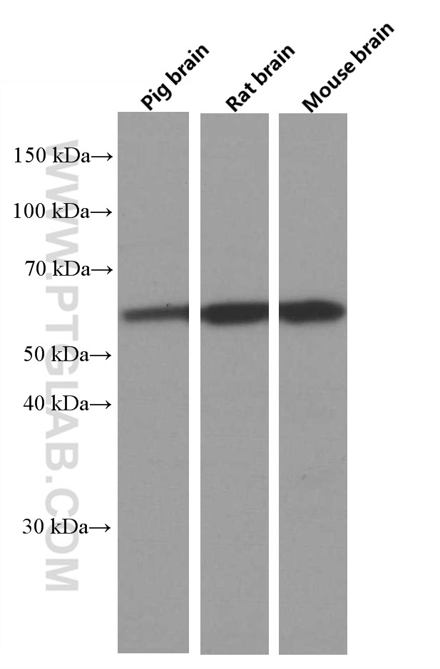 PPP3CB Monoclonal antibody
