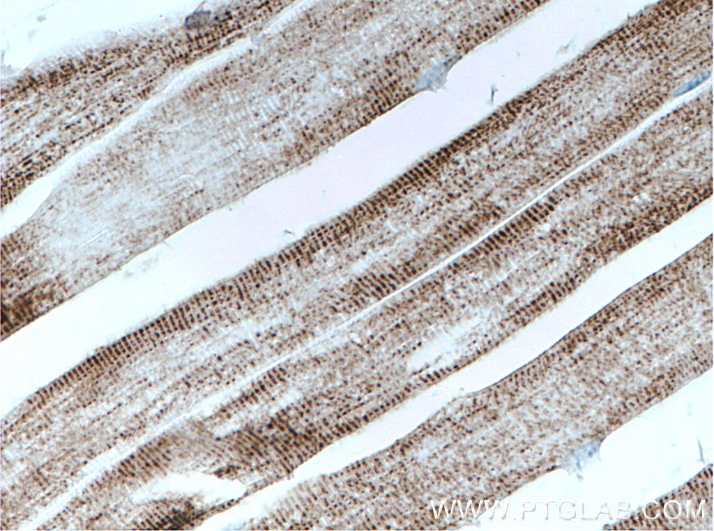 PC Monoclonal antibody