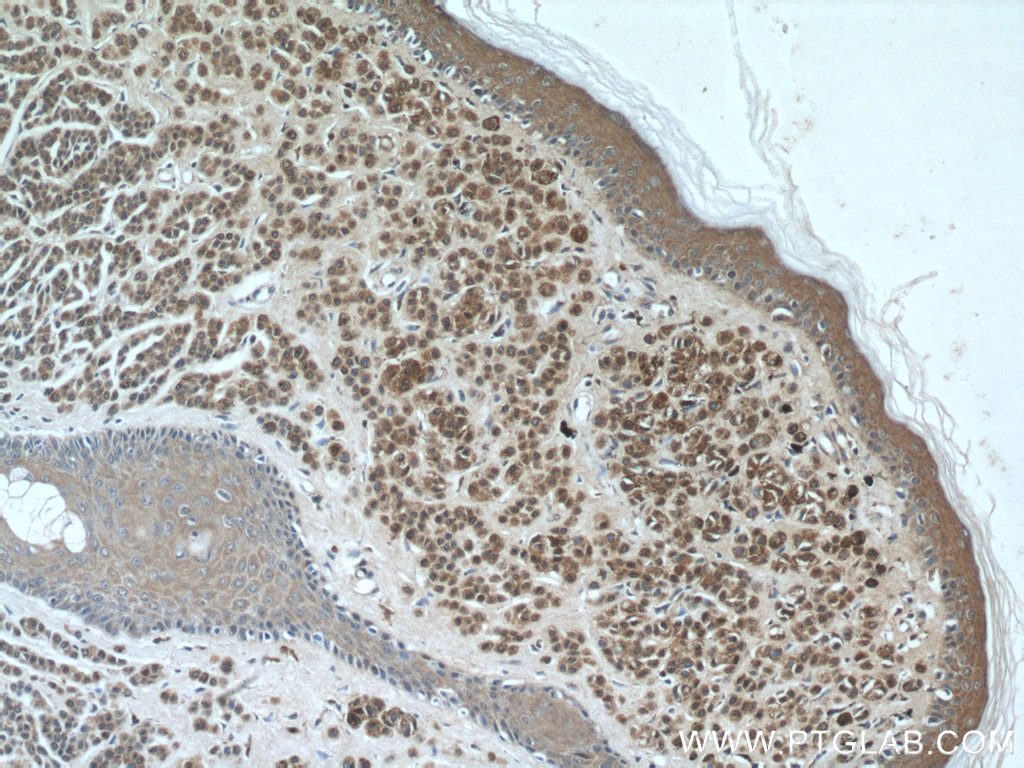 S100 Beta Monoclonal antibody