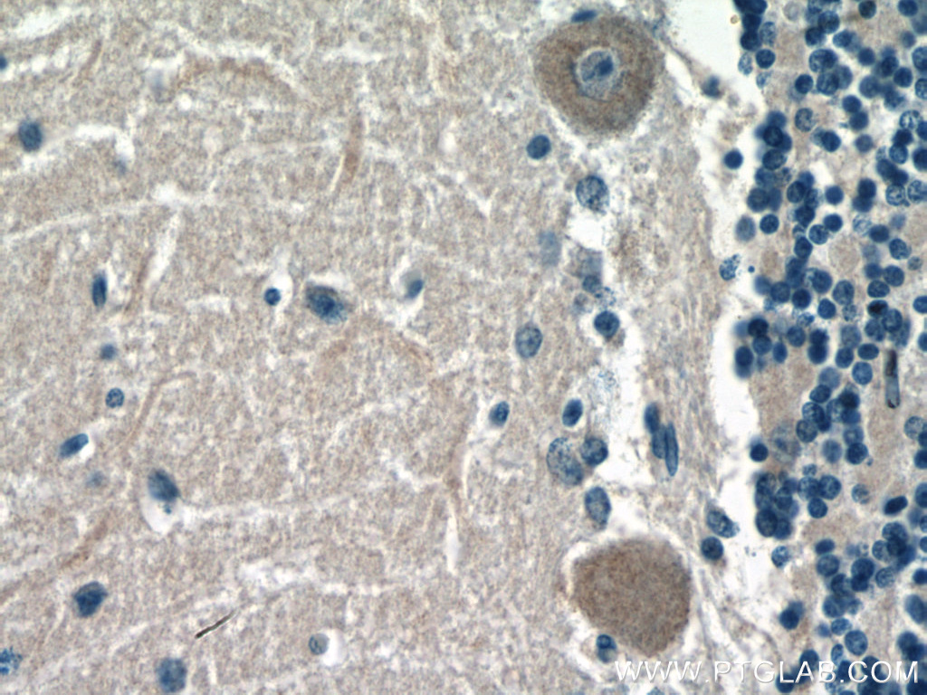 ACSL4 Monoclonal antibody