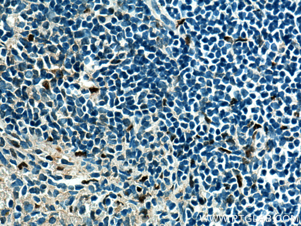 SPI1 Monoclonal antibody