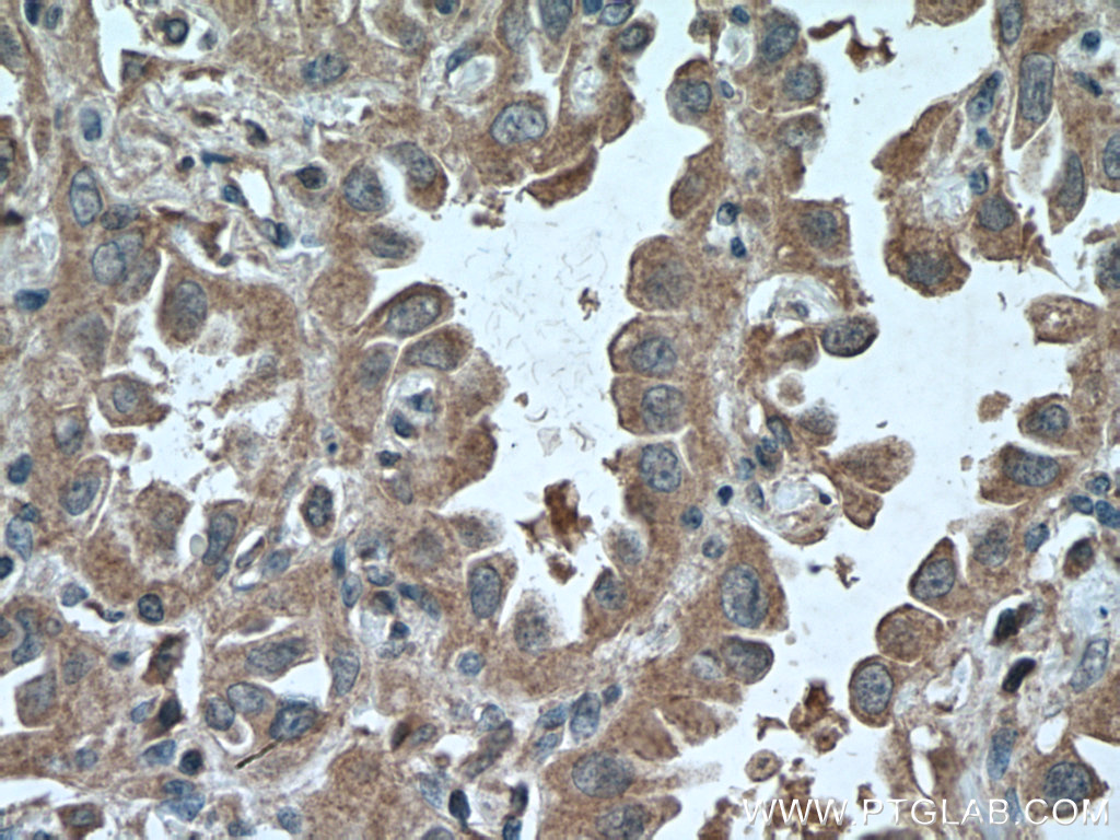 ADAM10 Monoclonal antibody