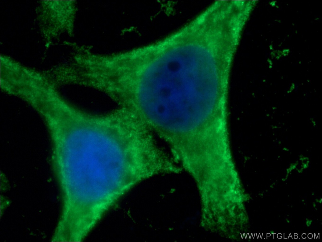 GSTA1 Monoclonal antibody