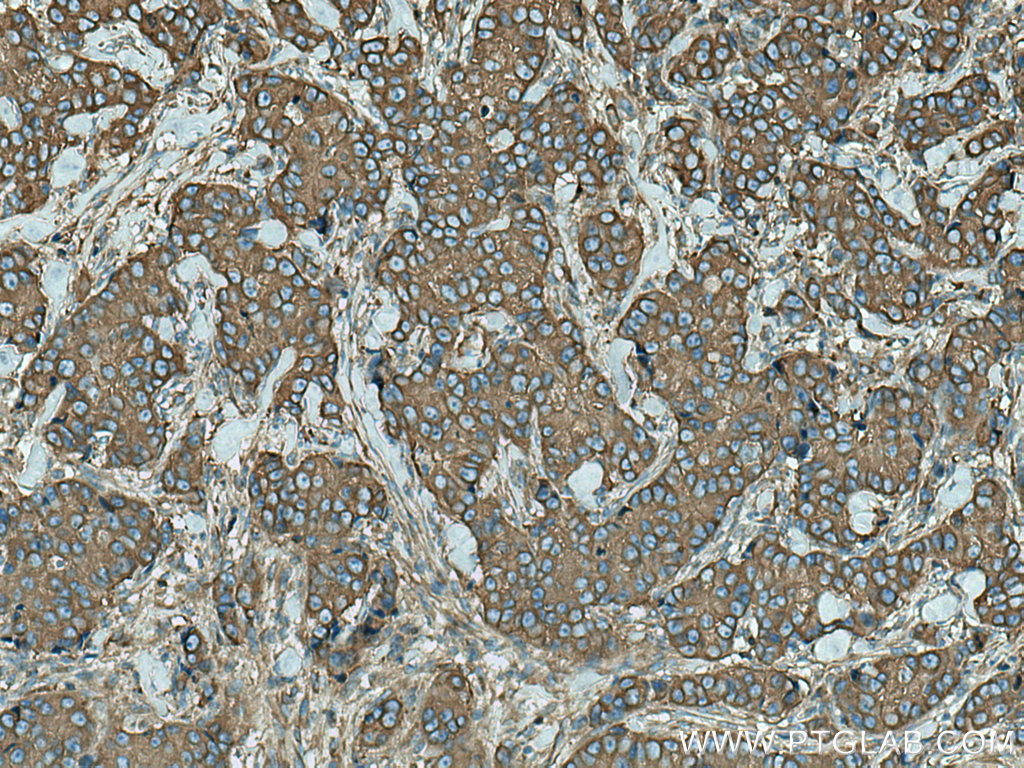 ACTN4 Monoclonal antibody