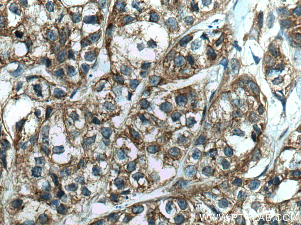 FAF2 Monoclonal antibody