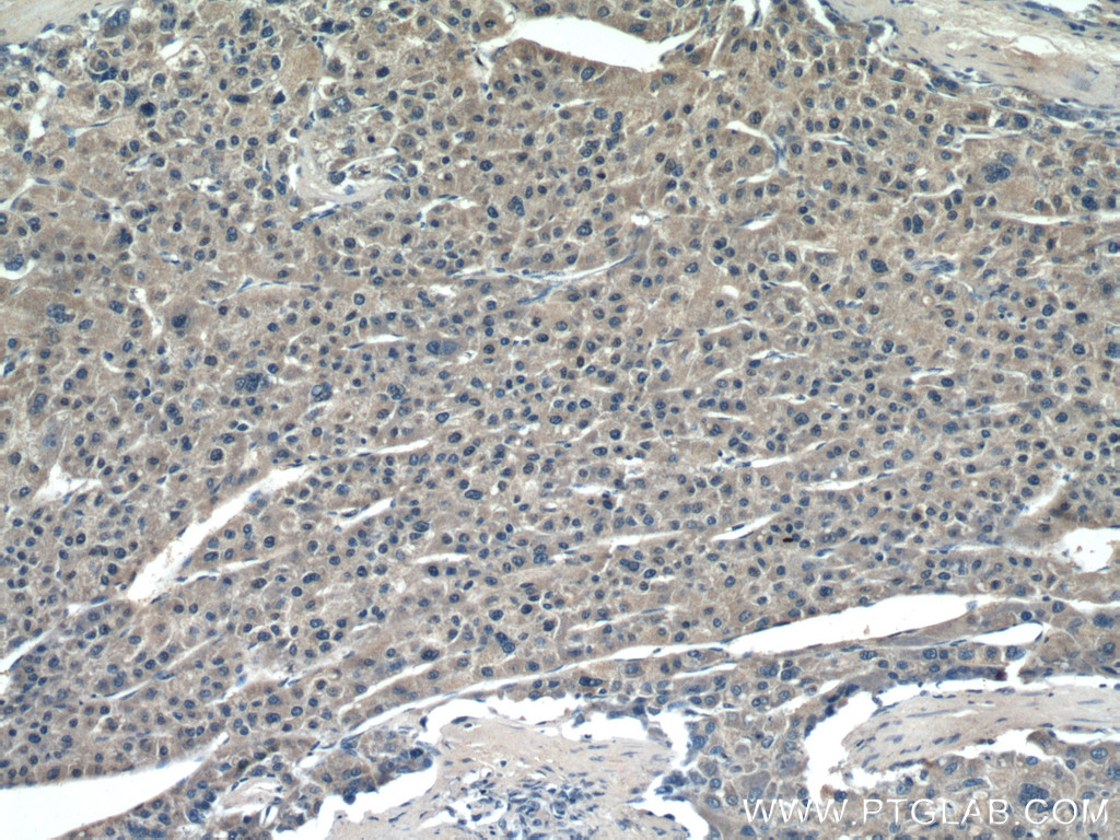 ROCK2 Monoclonal antibody
