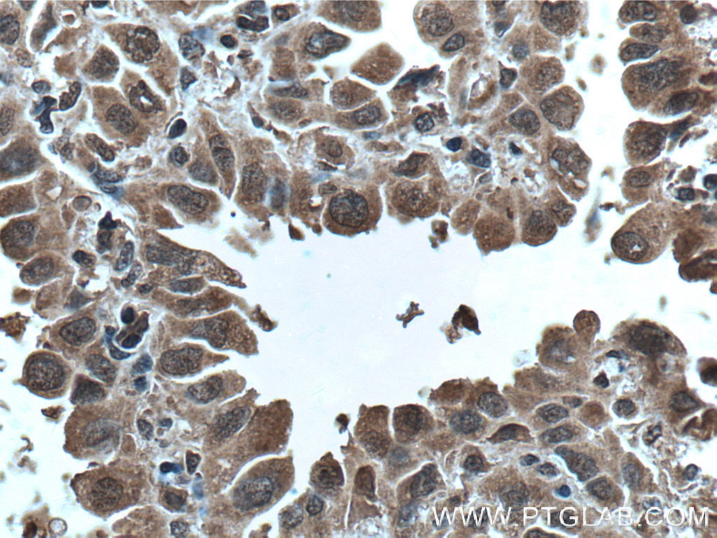 p70(S6K) Monoclonal antibody