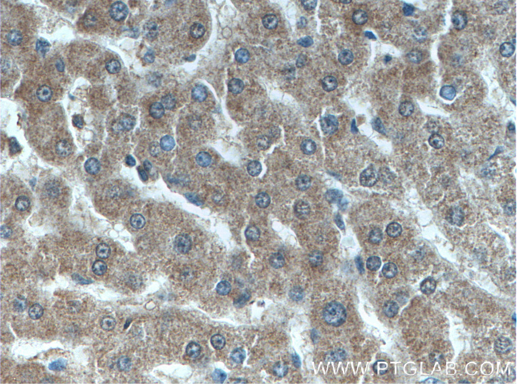 ANGPTL8 Monoclonal antibody