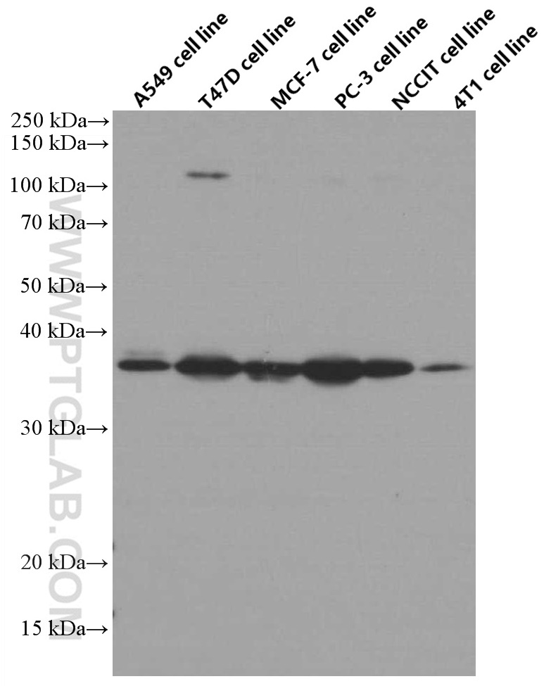 IGFBP2 Monoclonal antibody
