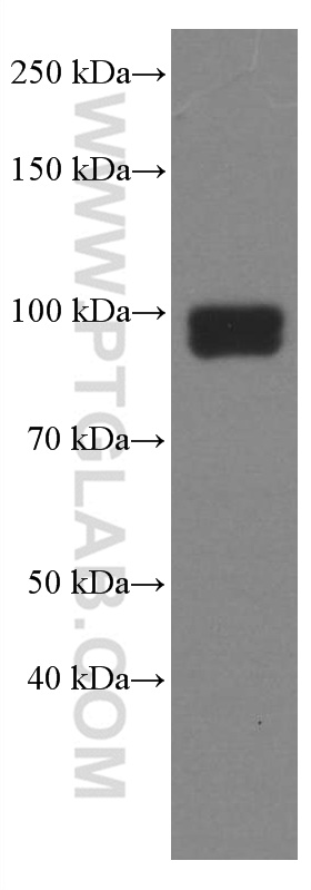 TLR2 Monoclonal antibody