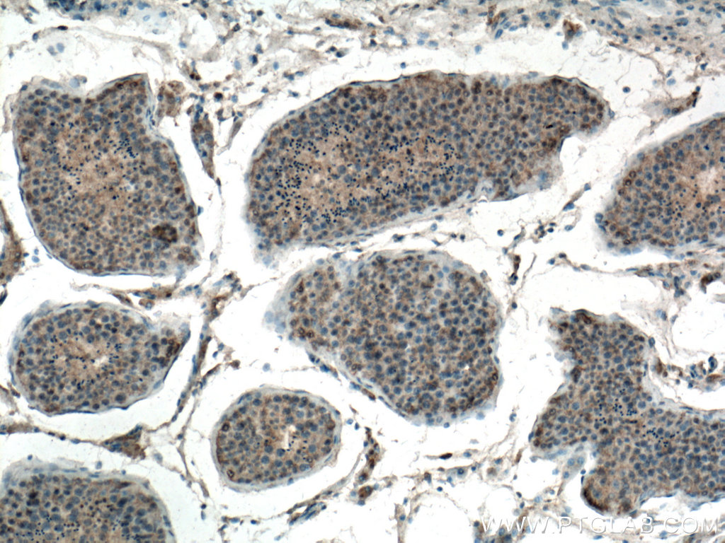 EIF2AK2 Monoclonal antibody