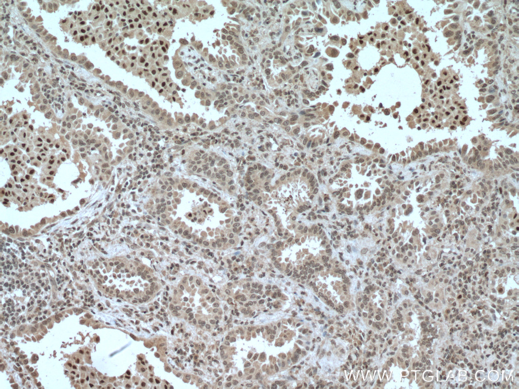 CEBPB Monoclonal antibody
