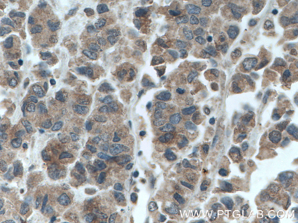 GRASP65,GORASP1 Monoclonal antibody