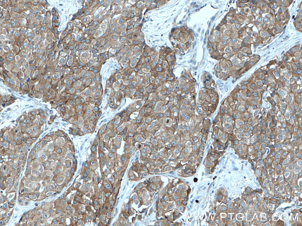 IRAK1 Monoclonal antibody