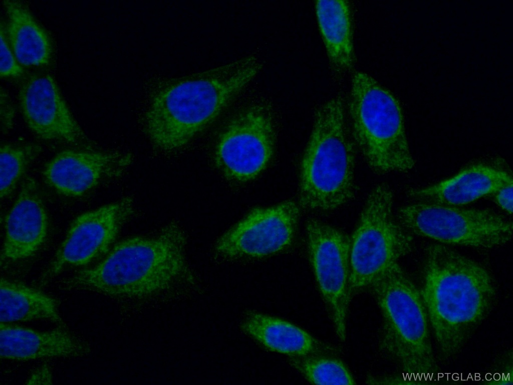 TOMM40 Monoclonal antibody