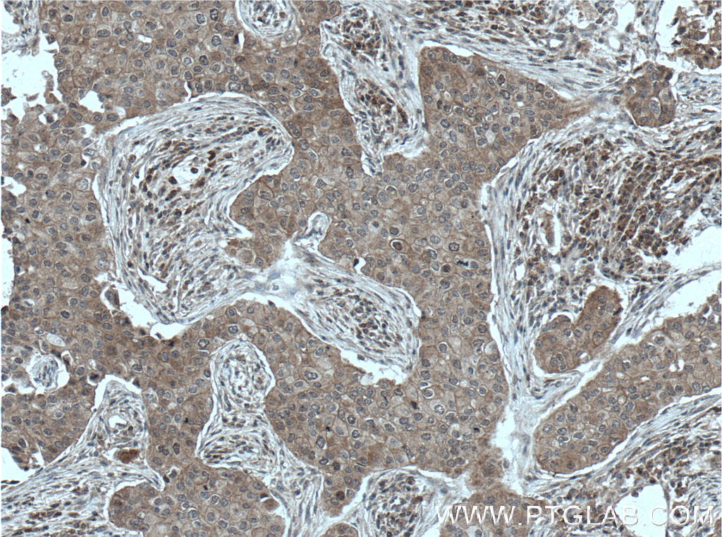BAG6 Monoclonal antibody