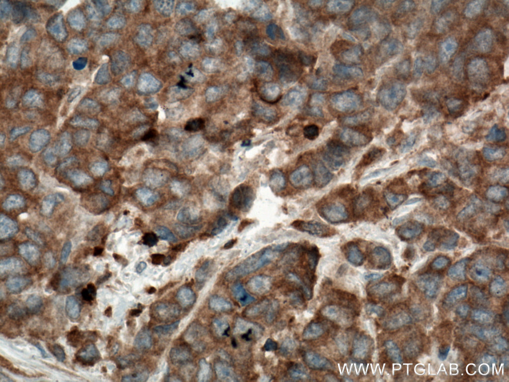 STK4 Monoclonal antibody