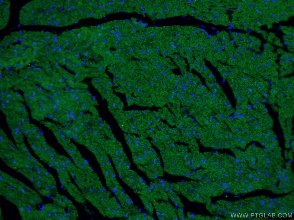 Beclin 1 Monoclonal antibody