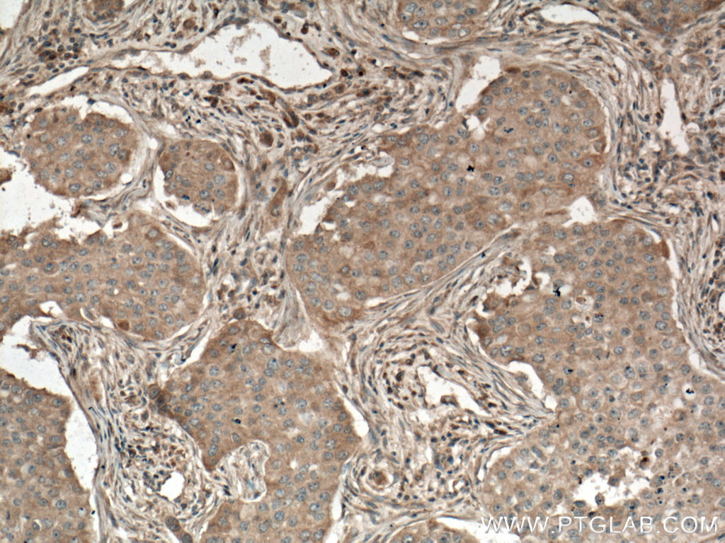 PLCB3 Monoclonal antibody