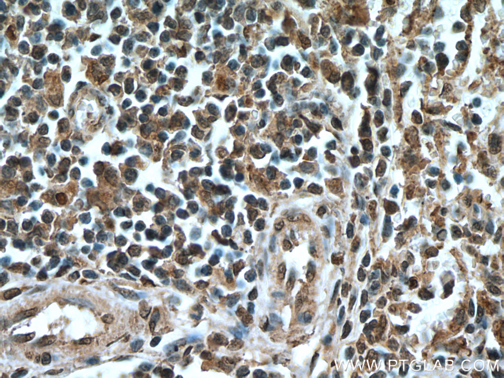 IRF3 Monoclonal antibody