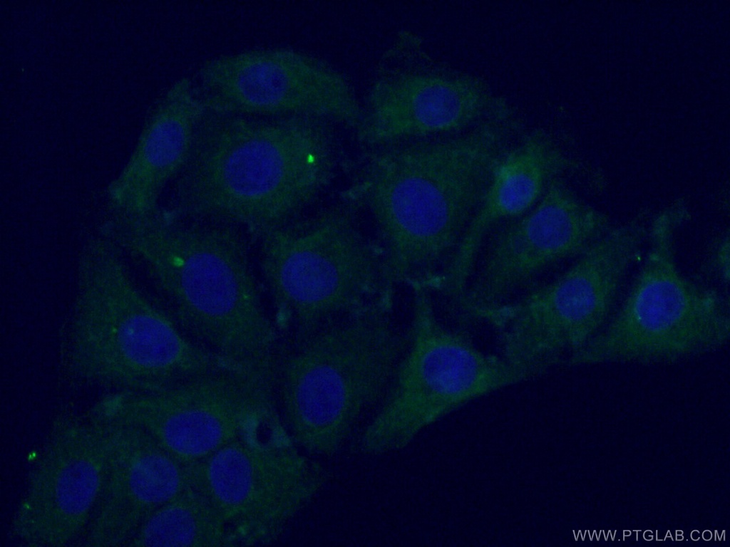 PARK2/Parkin Monoclonal antibody