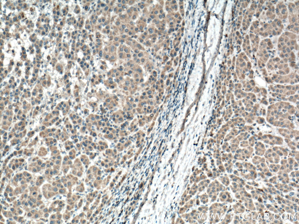 BBS10 Monoclonal antibody