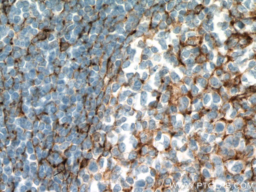 TMEM173/STING Monoclonal antibody