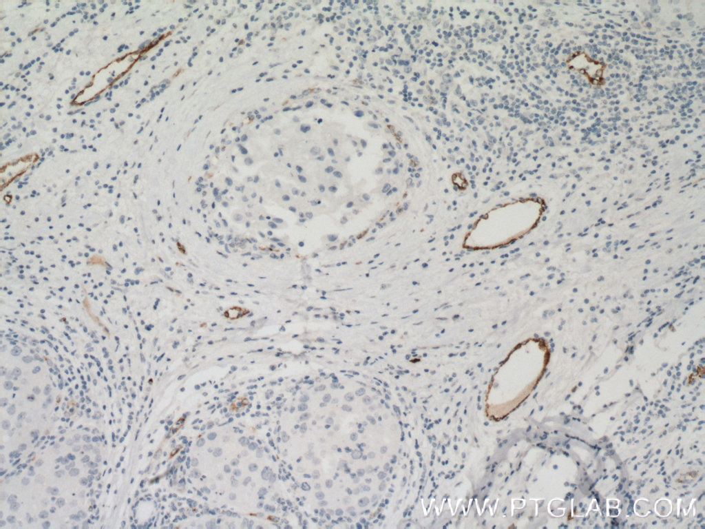 vwf Monoclonal antibody