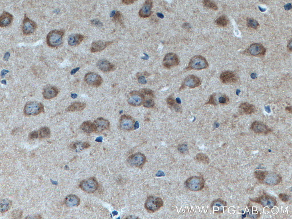 RAB3GAP1 Monoclonal antibody