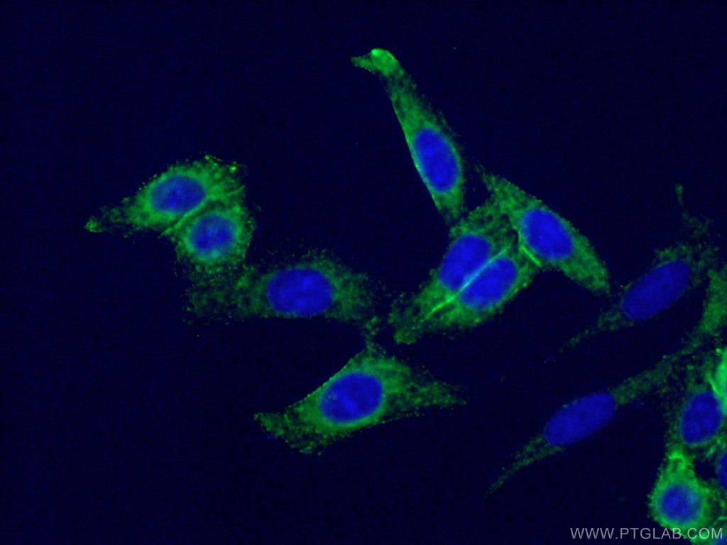 TNFAIP3 Monoclonal antibody