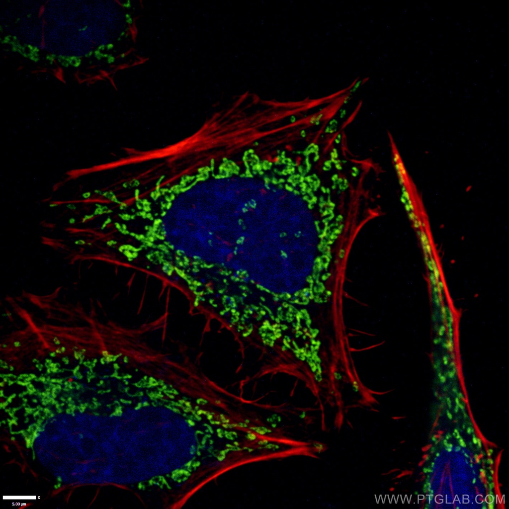 ATP5O Monoclonal antibody